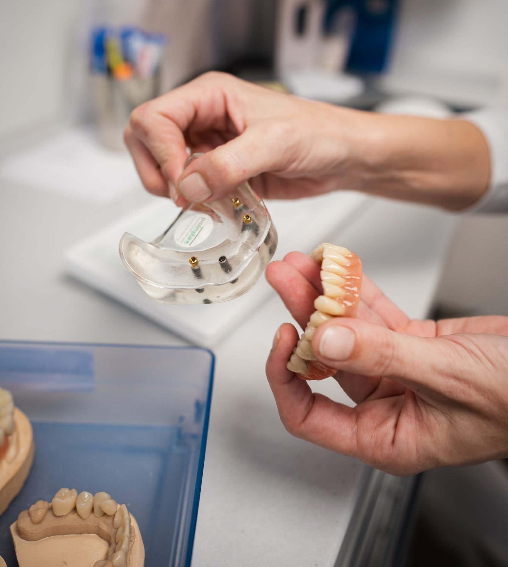 Zahnarzt hält Implantate in Köln um sie den Patienten einzusetzen